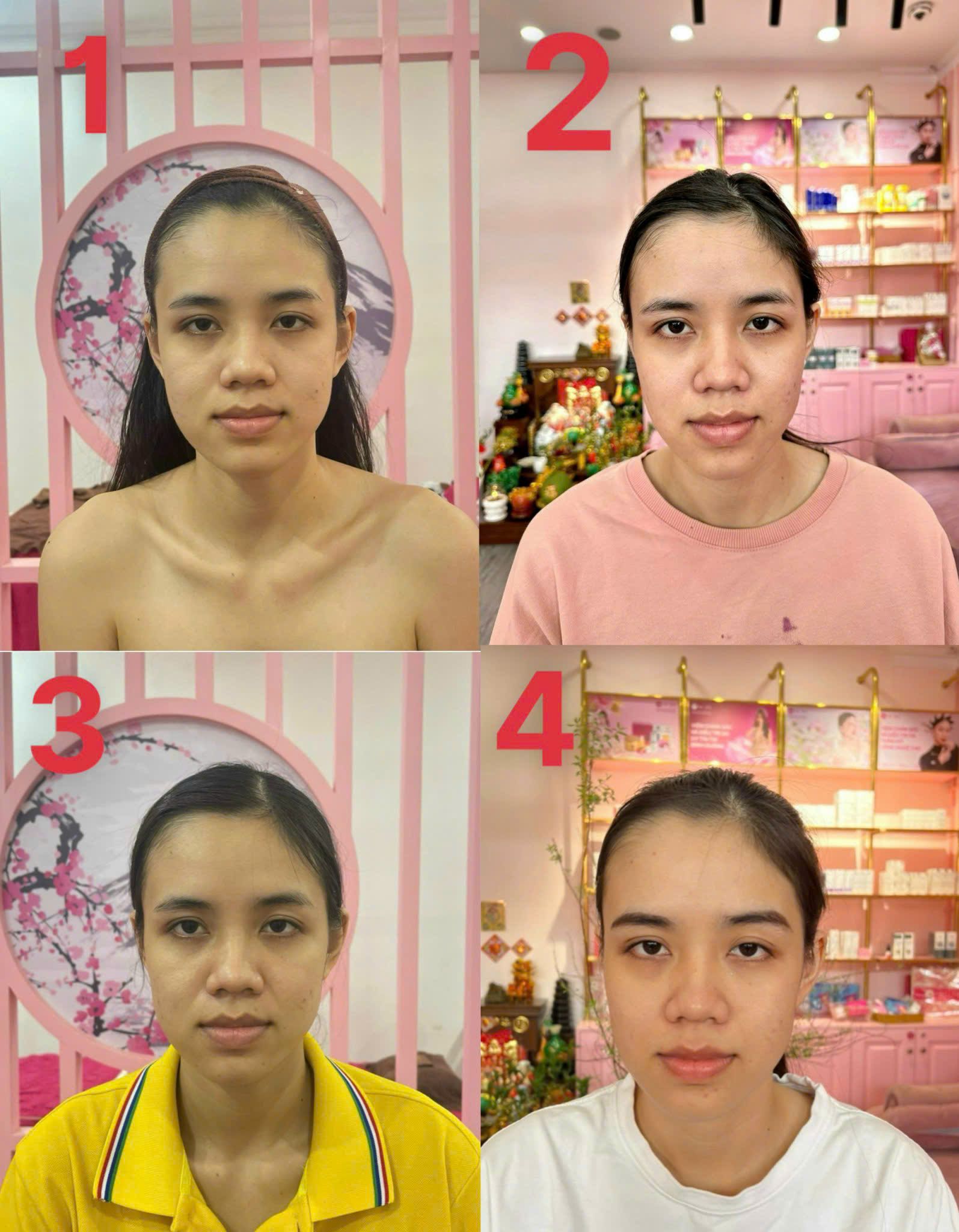 Before & After — Yoga Mặt 30 ngày